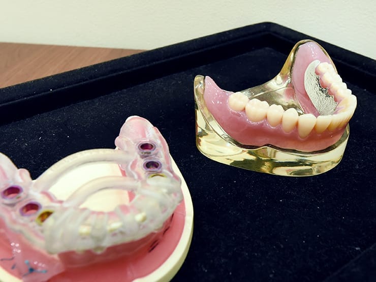 歯の模型2